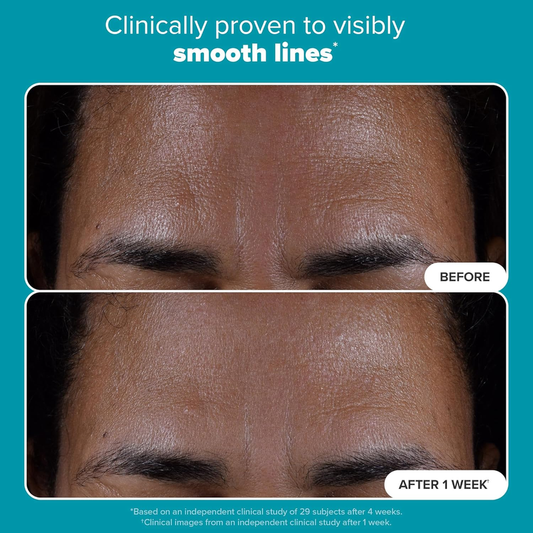 Paula’s Choice Skin Perfecting 2% BHA Liquid Exfoliant – 118 mL, Fragrance‑Free