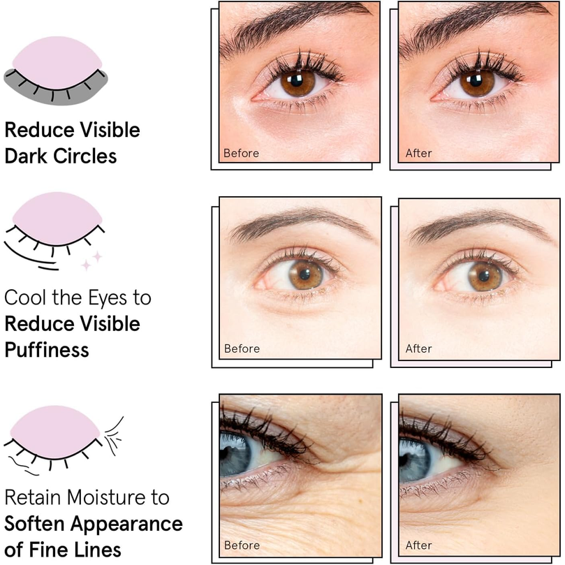 grace & stella Gold Under Eye Masks 48 Pairs – Vegan Gel Patches for Puffiness