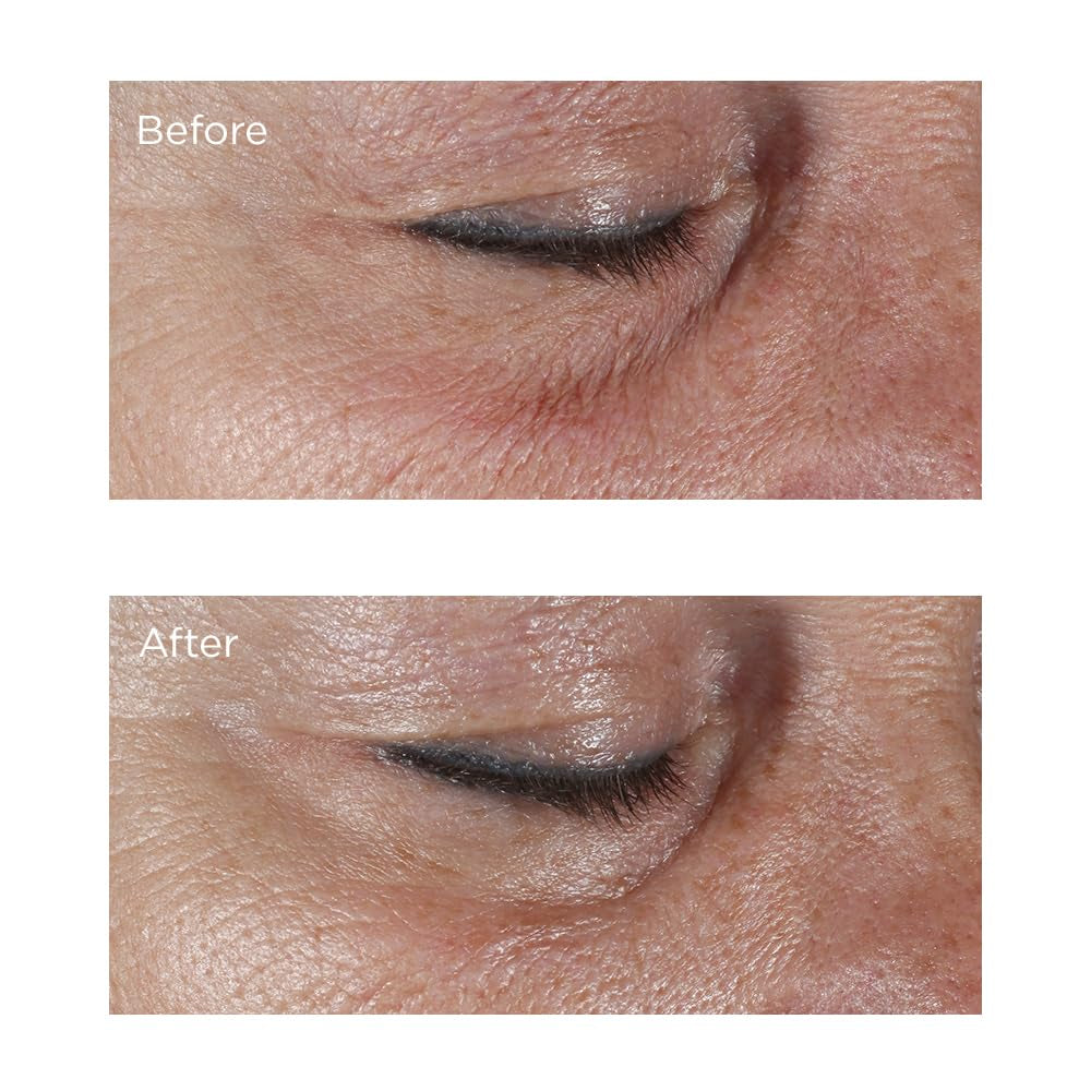 Perricone MD Hypoallergenic Firming Eye Cream, New - 0.5 Oz