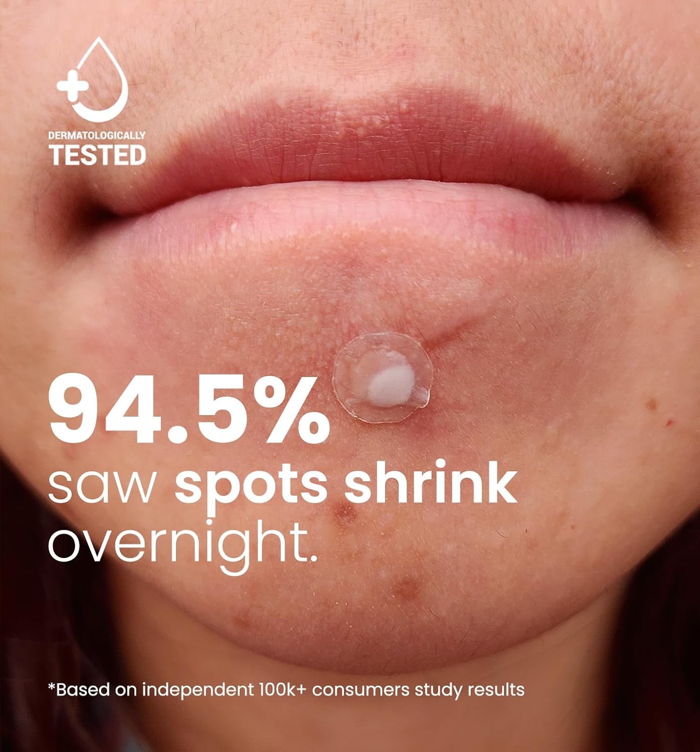 ROSELYNBOUTIQUE Pimple Patches for Face 300 Counts 4 Sizes Hydrocolloid Acne Patches with Tea Tree Oil,Zits Blemishes Pore Strips - Vegan Facial Skin Care Products Cruelty-Free