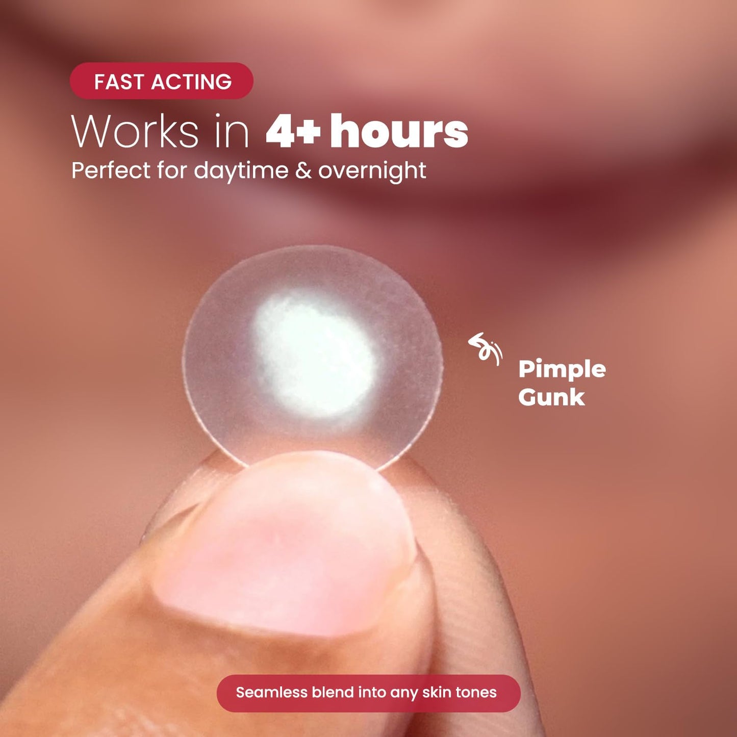 ROSELYNBOUTIQUE Pimple Patches for Face 300 Counts 4 Sizes Hydrocolloid Acne Patches with Tea Tree Oil,Zits Blemishes Pore Strips - Vegan Facial Skin Care Products Cruelty-Free