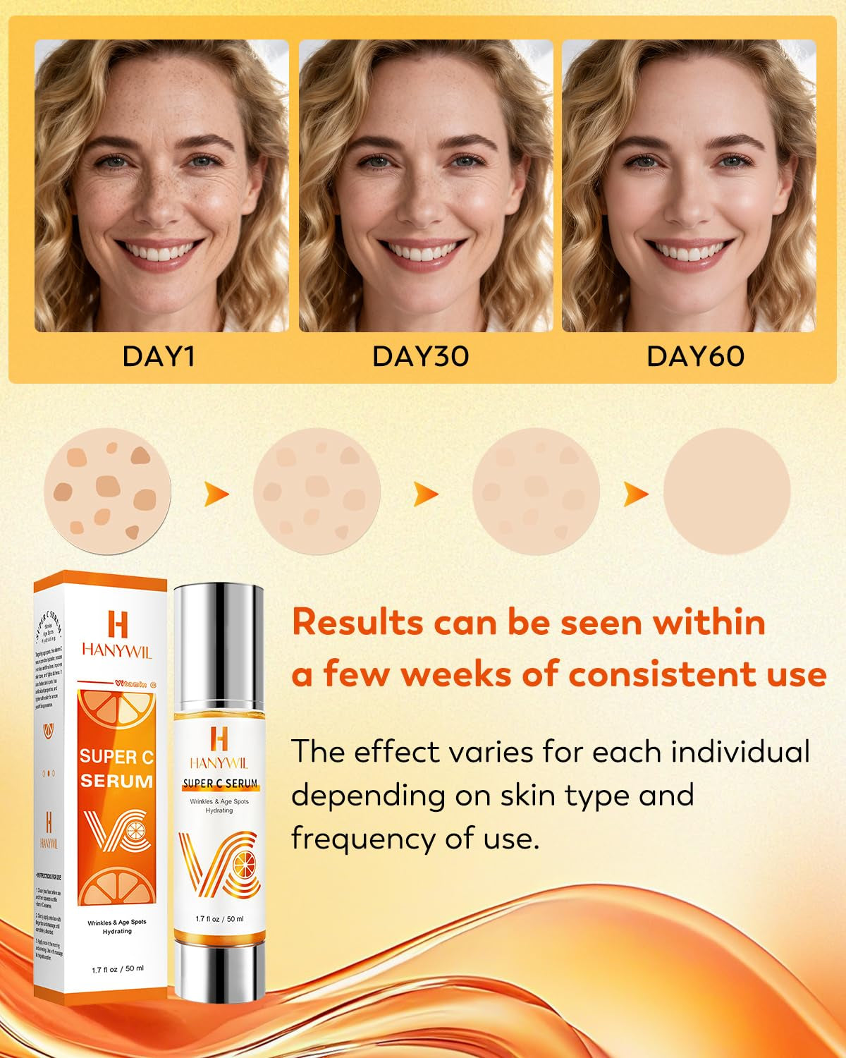 HANYWIL 20% Super Vitamin C Serum for Mature Skin 30-70 Women, Dark Spot Remover with Hyaluronic Acid & Active Lock Tech, Hydrating Total Package Serum for Wrinkles & Firming, Even Skin Tone, 1.7Fl Oz