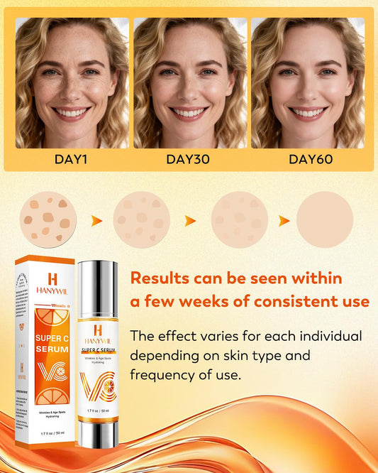 HANYWIL 20% Super Vitamin C Serum for Mature Skin 30-70 Women, Dark Spot Remover with Hyaluronic Acid & Active Lock Tech, Hydrating Total Package Serum for Wrinkles & Firming, Even Skin Tone, 1.7Fl Oz