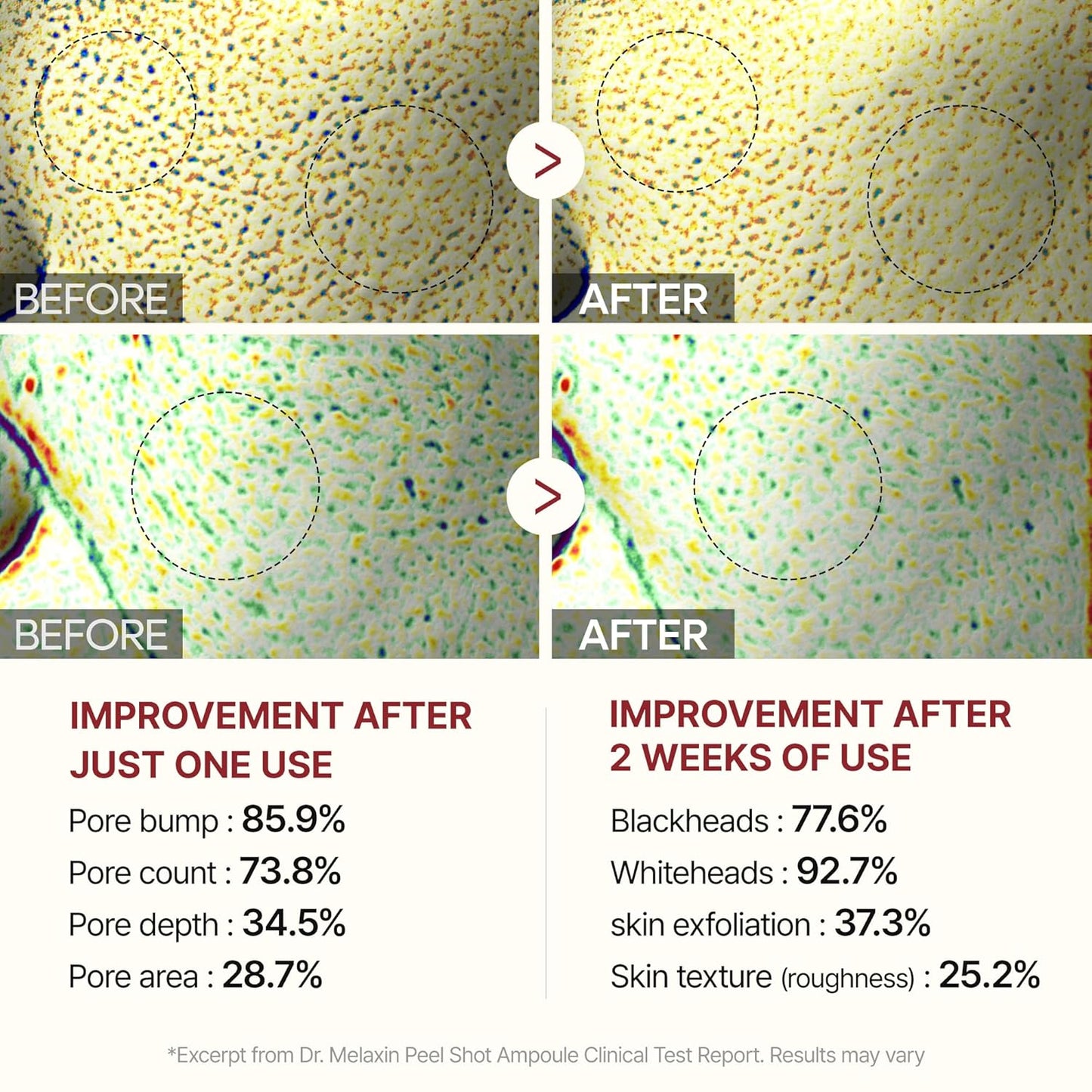 Dr.Melaxin Peel Shot Glow Rice Peeling Ampoule 80Ml Daily Soft Exfoliating Face and Body Scrub Dead Skin Cells Blackhead Remover for All Skin Types Korean Skin Care