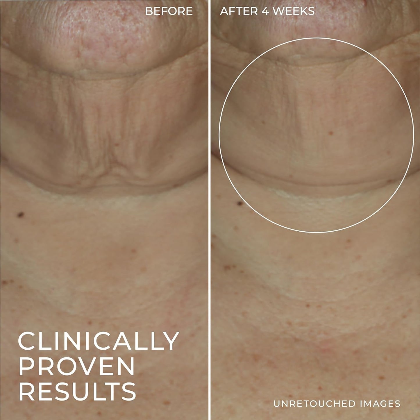 Roc Derm Correxion Retinol Firming Serum Stick with Antioxidants to Visibly Tighten and Firm Wrinkles and Laugh Lines 1.0 Oz plus Retinol Eye Cream Packette