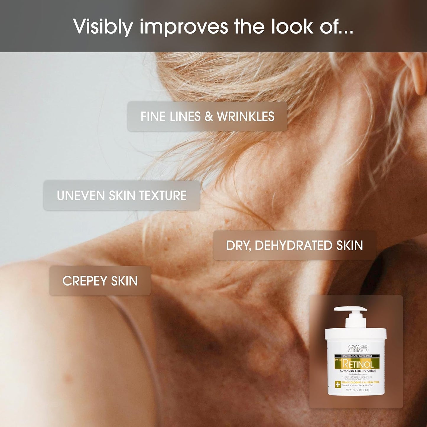 Advanced Clinicals Retinol Body Lotion & Face Moisturizer | Visible anti Aging Skin Care Retinol Body Cream for Women & Men Targets Look of Fine Lines, Wrinkles, & Crepe Looking Dry Skin, 16 Ounce