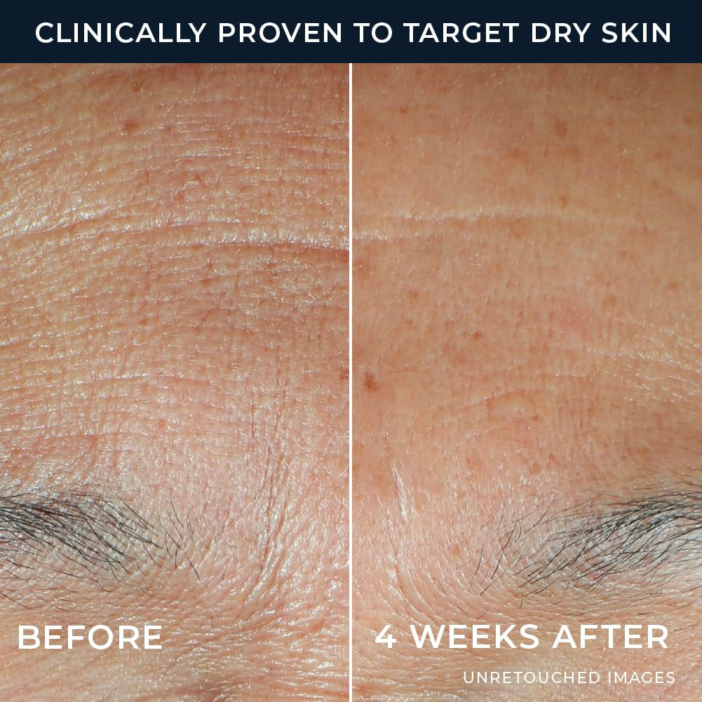 Roc Multi Correxion Hyaluronic Acid Night Serum Capsules