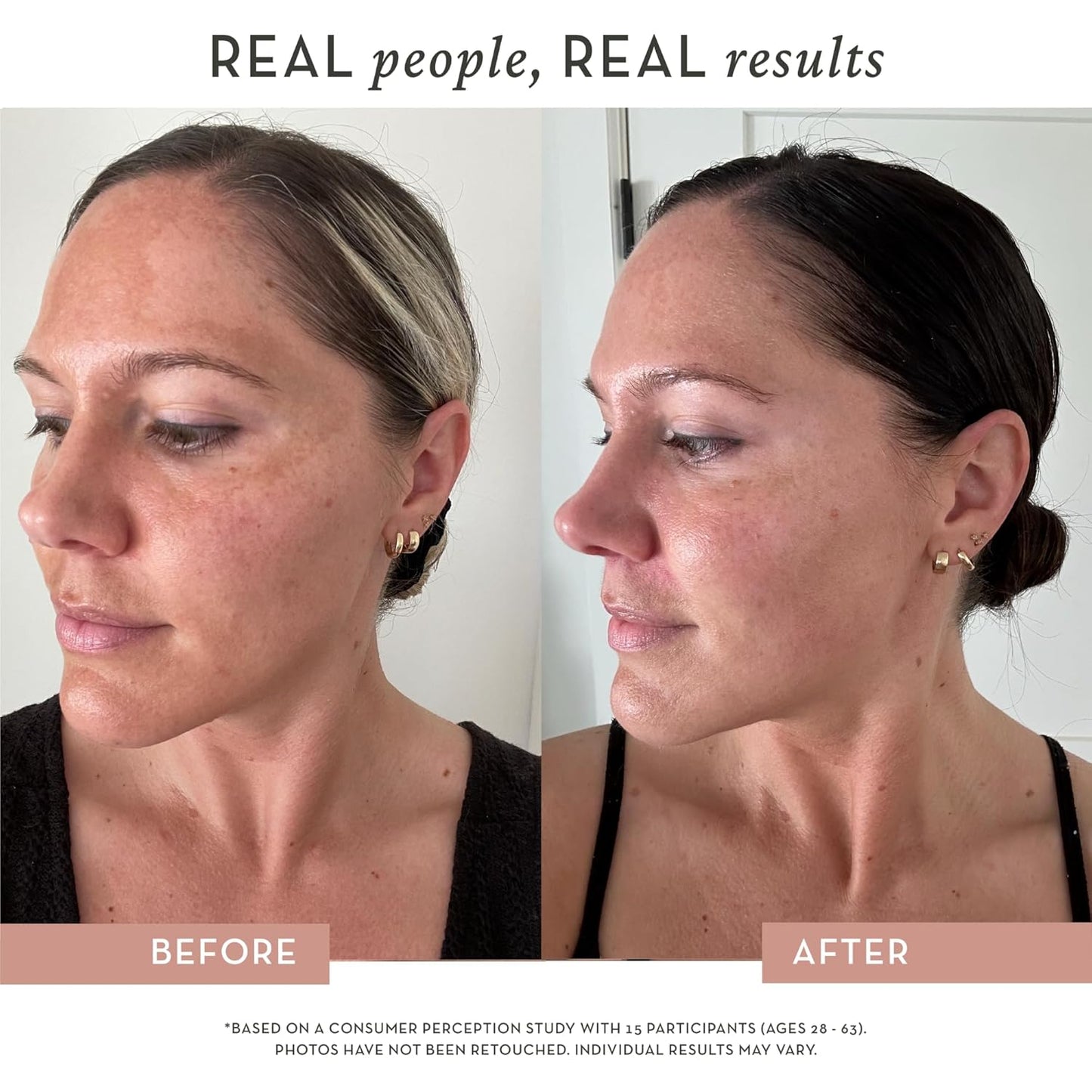 Vitamin C Serum for Face – All-In-One Formula – Profesional Grade Vitamin C, Peptides, 3X Hyaluronic Acid, and Niacinamide – for Sensitive Skin and Anti-Aging – Brightens, Firms & Hydrates – 1 Oz