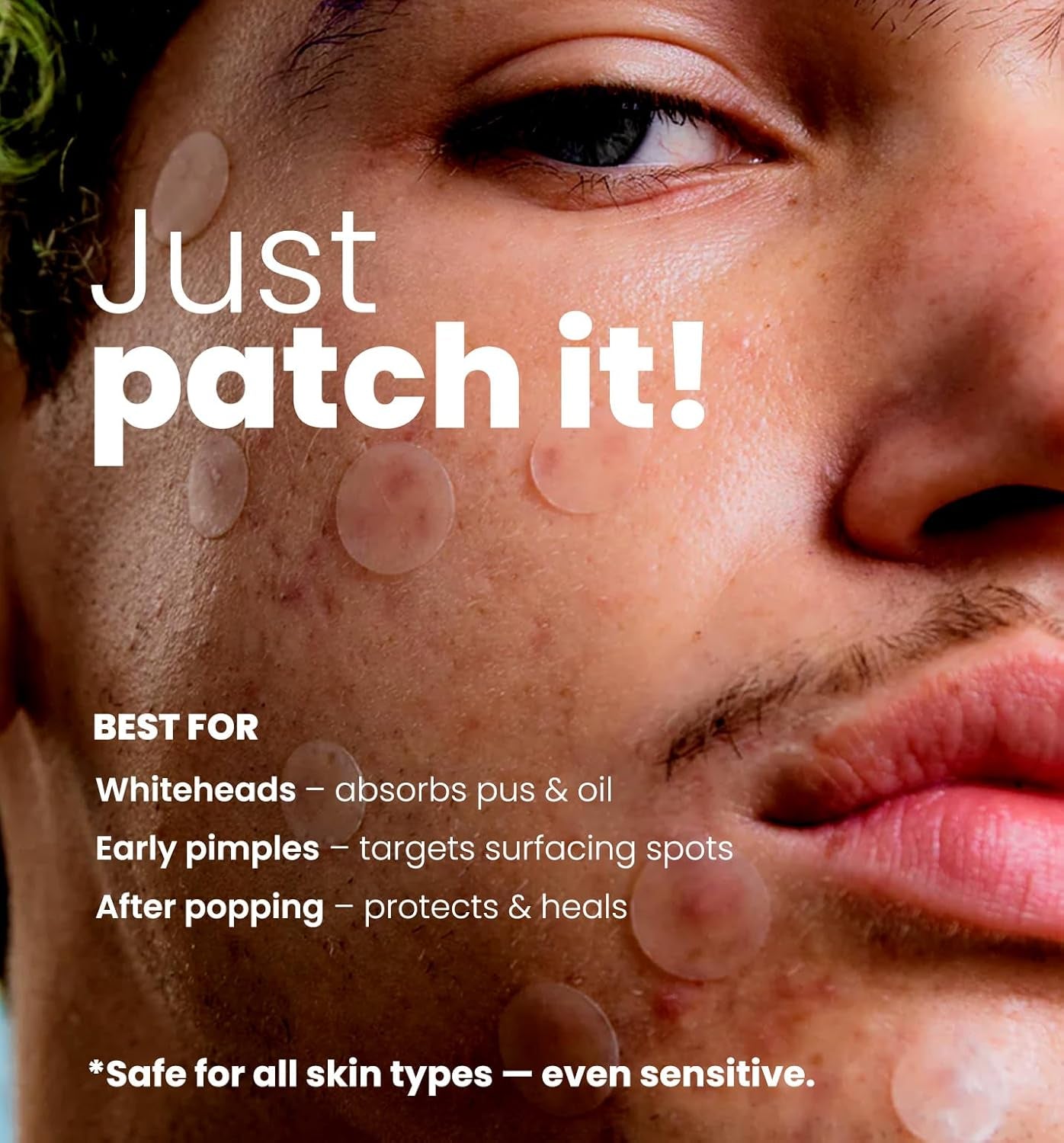 ROSELYNBOUTIQUE Pimple Patches for Face 300 Counts 4 Sizes Hydrocolloid Acne Patches with Tea Tree Oil,Zits Blemishes Pore Strips - Vegan Facial Skin Care Products Cruelty-Free