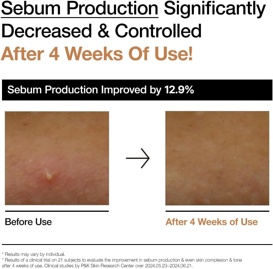 ANUA Rice 70 Glow Milky Toner, for Glass Skin, Rice Water, Niacinamide, Ceramides, Panthenol, Fragrance-Free, Non Comedogenic, Fungal Acne Safe, Korean Skin Care, 250Ml/8.45Fl.Oz.